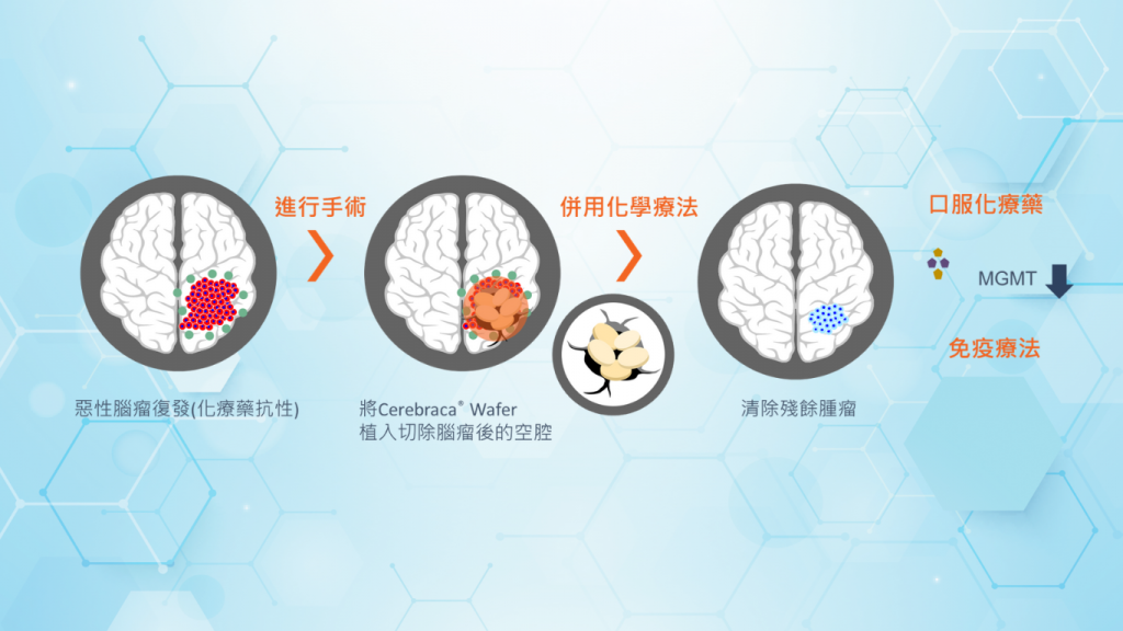 EF-001治療腦癌的方式