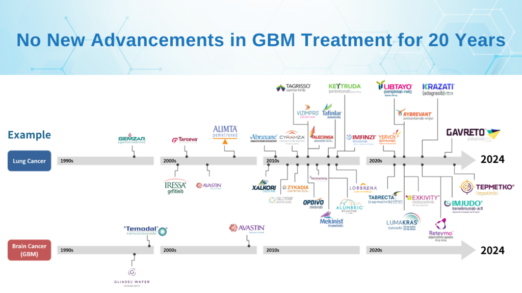 No New Advancements in GBM Treatment for 20 Years